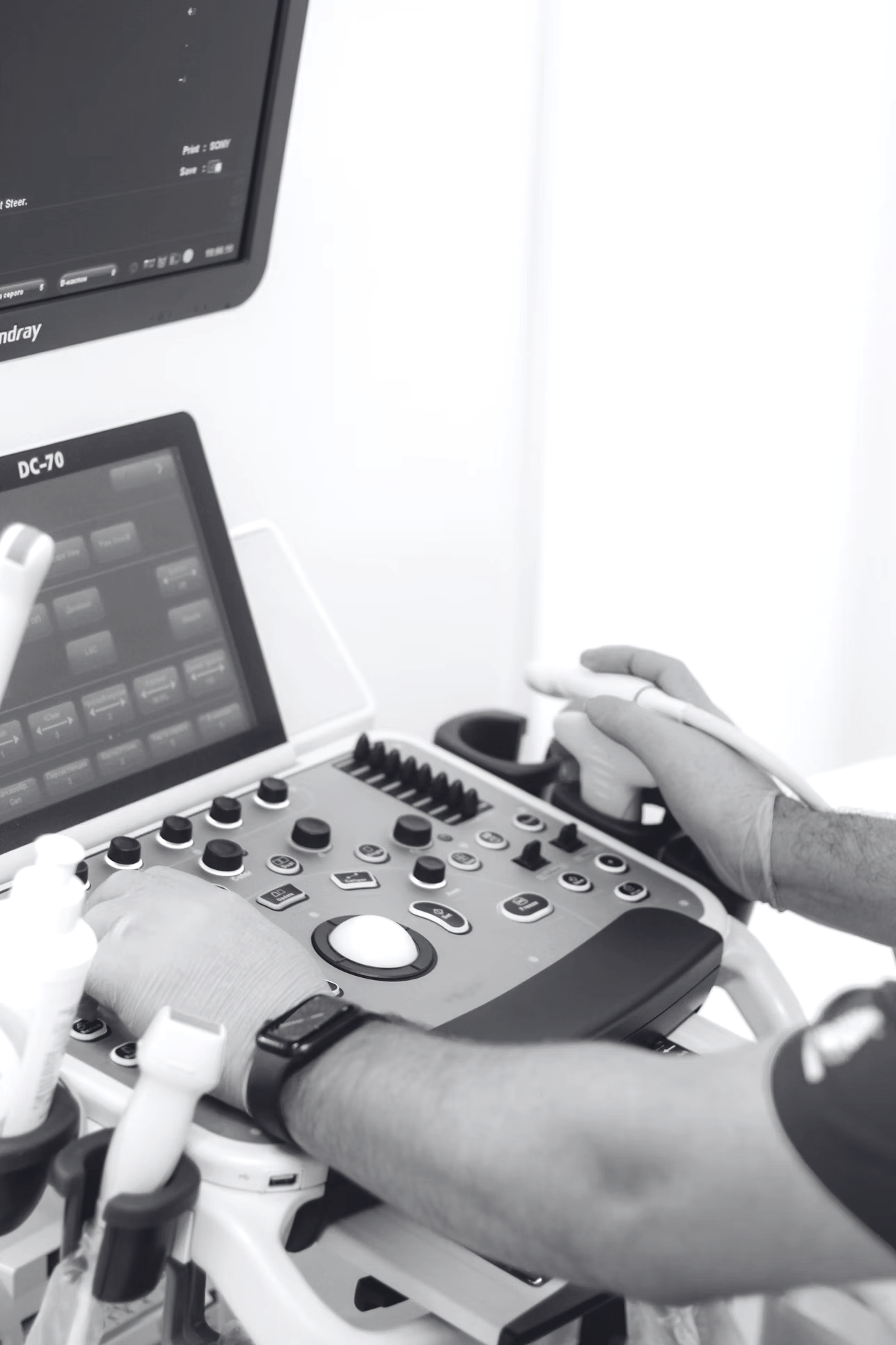 Ultrasound procedure